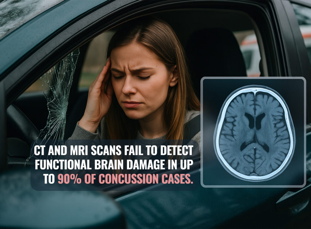 Minor Car Wreck MRI Image Minor Car Wreck MRI Image